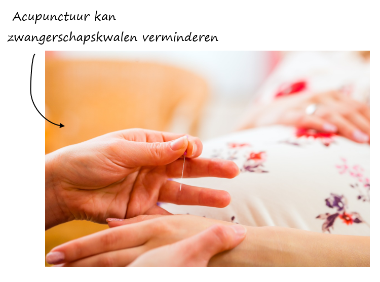acupunctuur tijdens de zwangerschap